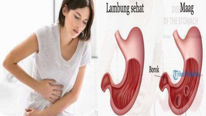 cara mengobati Penyakit asam lambung